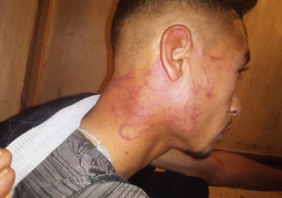 طالب يتهم عناصر شرطة بزاكورة بالاعتداء عليه ضربا وسبّا و