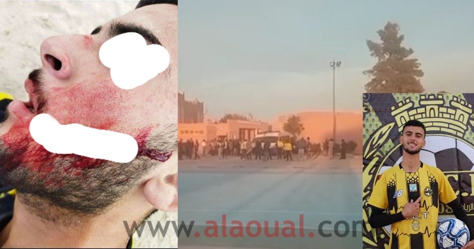 مصيبة.. شغب وعنف ببيوكري بعد انتهاء مباراة وإصابة لاعب بالسلاح الأبيض والاعتداء على شرطي وحارس